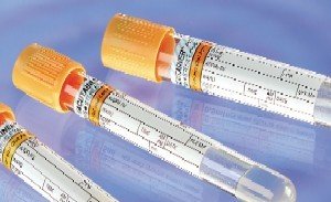 9 ML PIHTI AKTİVİTÖRLÜ JELSİZ BİYOKİMYA TÜPÜ